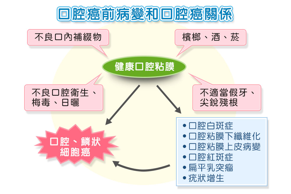 口腔癌前病變和口腔癌關係